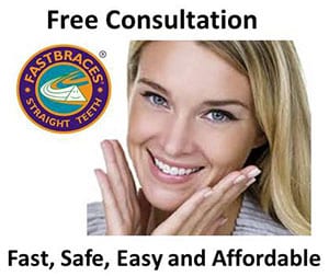 fastbraces - Orthodontic Braces